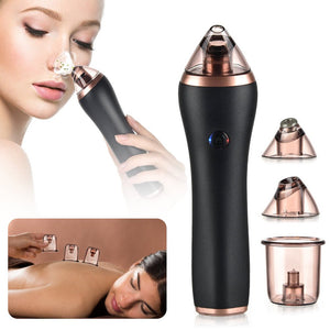 4 in 1 Body Guasha Cupping Blackhead Remover Machine Facial Pore Deep Cleansing Beauty Skin Care - Zambeel