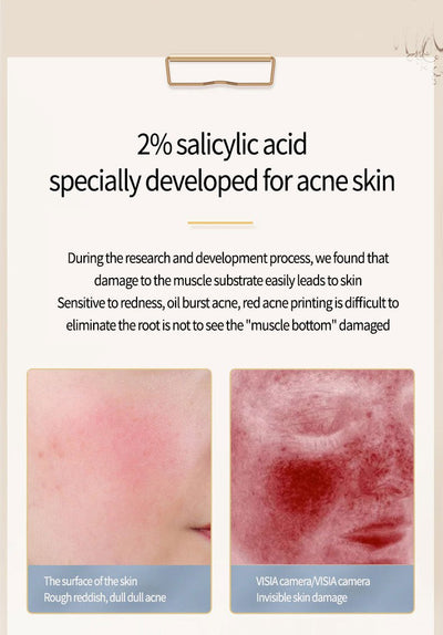 Acne Removing Salicylate Products - Zambeel