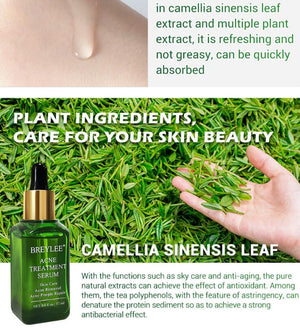 Acne Treatment Serum Facial Repair Oil - Zambeel