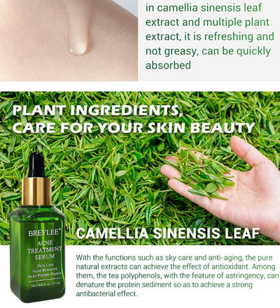 Acne Treatment Serum Facial Repair Oil - Zambeel