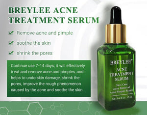 Acne Treatment Serum Facial Repair Oil - Zambeel