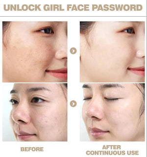 Ashley Shine - Niacinamide Pure Serum - Zambeel