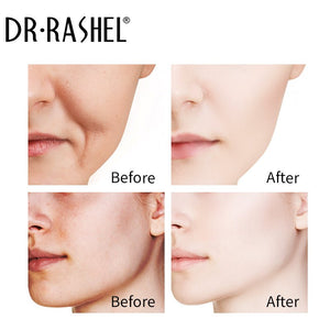 Dr Rashel - Complete Facial Serum Set - Zambeel