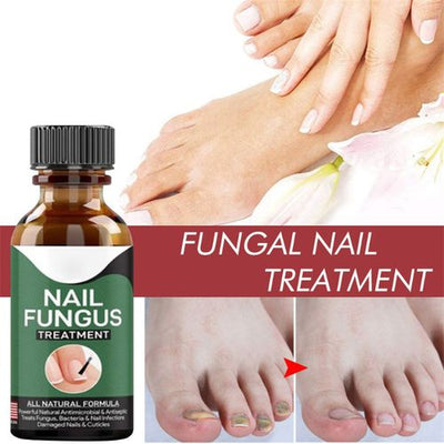 Fast Nail Fungal Treatment Serum - Zambeel
