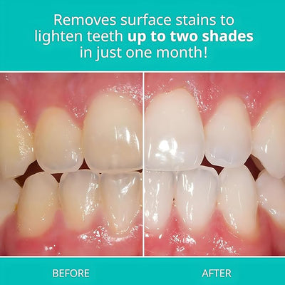 Opalescence - Whitening Toothpaste - Zambeel