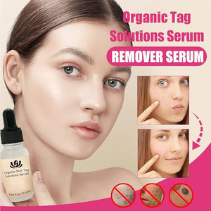 Organic Skin Tag Solutions Serum - Zambeel