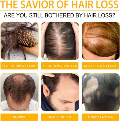 OUHOE - Biotin Hair Growth Serum - Zambeel