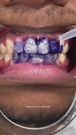 Hismile  - Teeth Brightening Serum V34