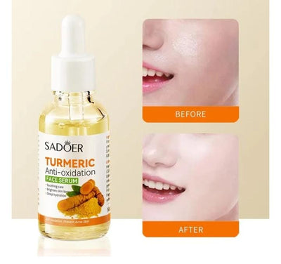 Sadoer - Tumeric Anti oxidation Face Serum - Zambeel