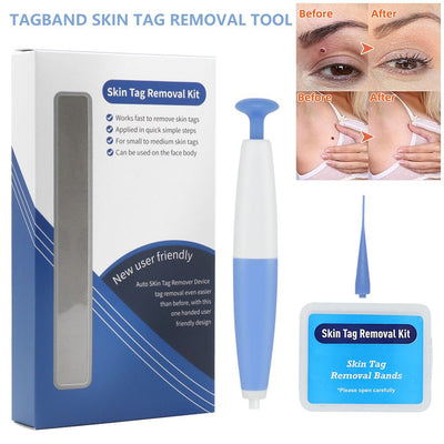 Skin Tag Removal Kit Home Use Mole Wart Remover Micro Band Skin Tag Treatment Tool Easy To Clean Skin Care Tool - Zambeel