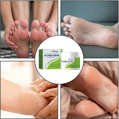 South Moon - 42% Urea Cream (Original) - Zambeel