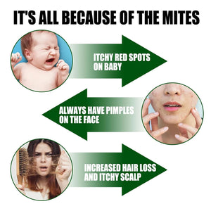 South Moon - Green Prickly Ash Herbal Mite Remover (Original) - Zambeel