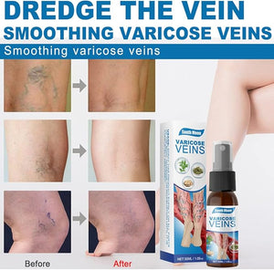 South Moon - Varicose Veins (Original) - Zambeel