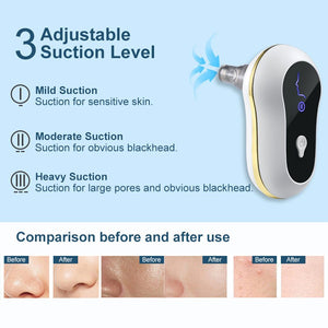 Suction Blackhead Remover Kit Electric Facial Pore Cleanser Acne Cleaner - Zambeel
