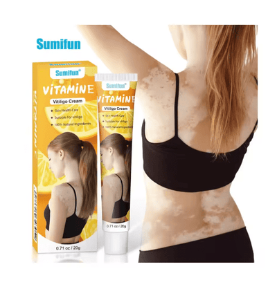 Sumifun - Vitamine Vitiligo Cream (Original) - Zambeel
