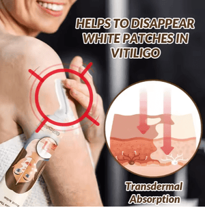 Sumifun - Vitiligo Removal Cream (Original) - Zambeel