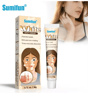 Sumifun - Vitiligo Removal Cream (Original) - Zambeel