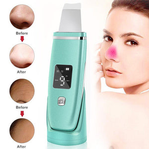 Ultrasonic Vibration Blackhead Remover Deep Cleansing Face Scrubber Pore Cleaner Lifting Machine Facial Led Peeling Shovel - Zambeel
