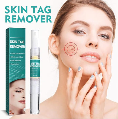 West & Month - Skin Tag Remover - Zambeel
